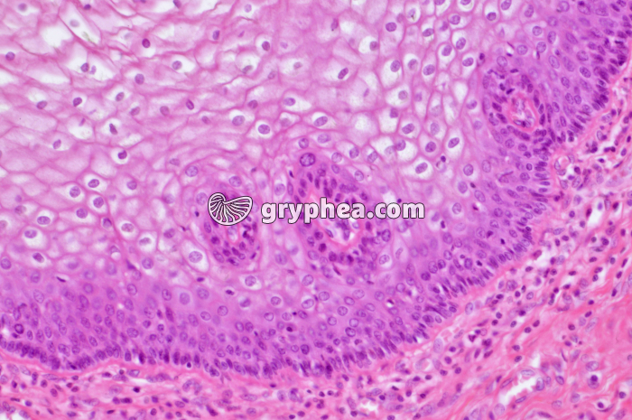 Muqueuse vaginale x100 - gryphea.com